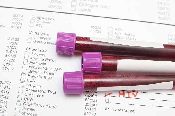 Vials of blood on top of a blood test form